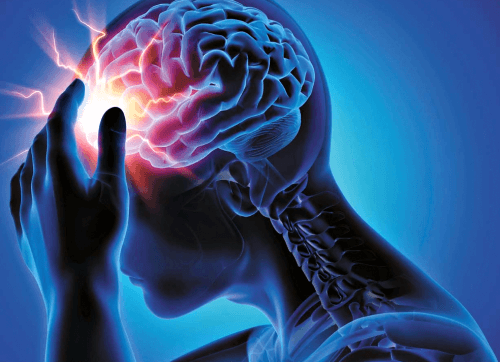뇌경색과 뇌출혈은 동시에 발생할 수 있을까?