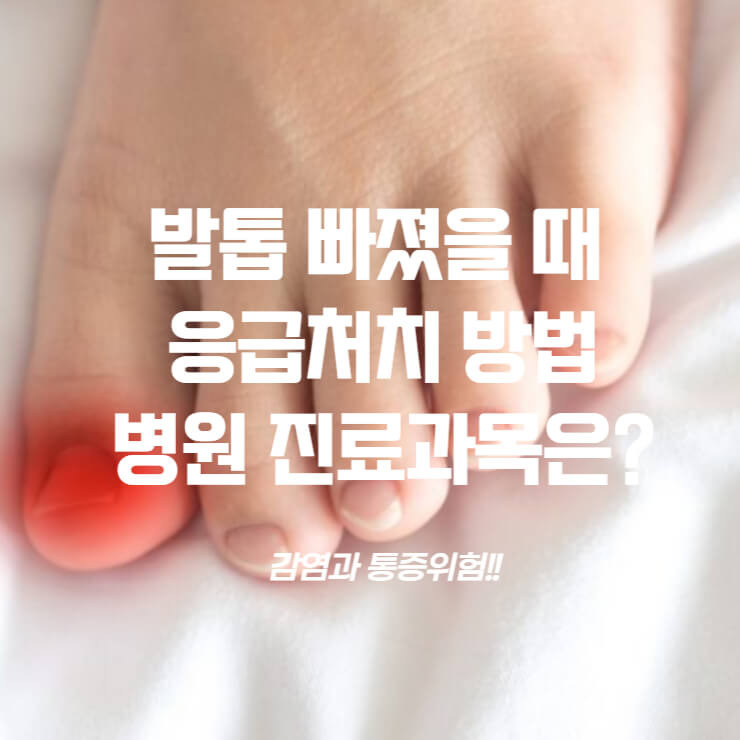 발톱 빠졌을 때 응급처치 방법, 병원 진료과목은?