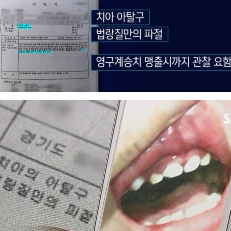 동두천 시립 어린이집 25개월 아이 넘어져 치아 파절 부러지고 피 나도 얼집 교사 '2시간 방치' 위치 어디? (+CCTV)
