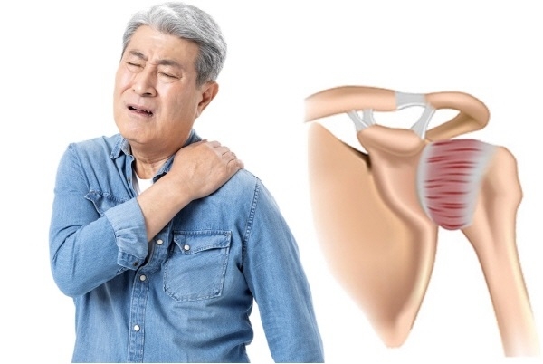 간단한 어깨 통증 진단법