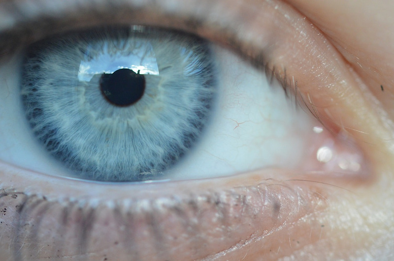 콘택트렌즈 종류와 특징