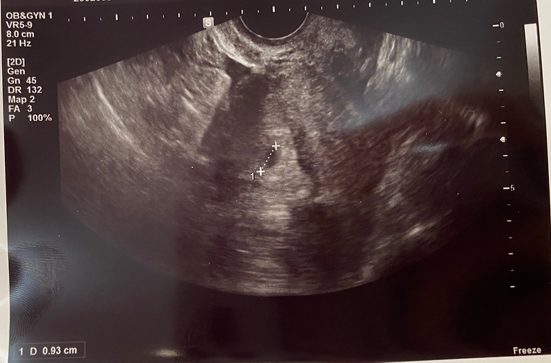 [임신/육아] 임신을 처음 알게된 순간 ‘임신테스트기’