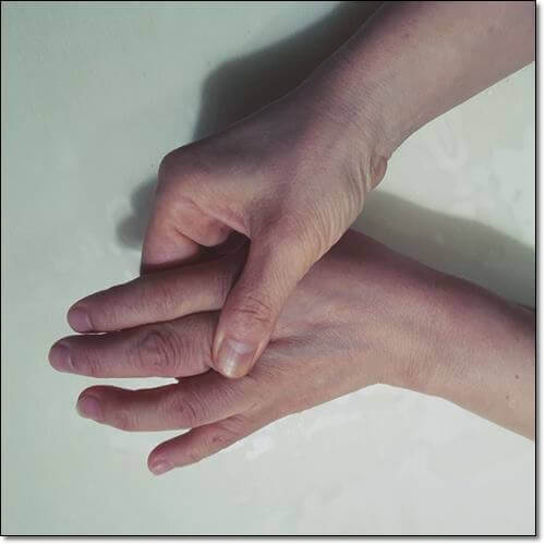 손가락 마디 통증 원인 및 증상과 치료