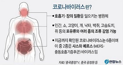 우환폐렴 코로나맵 바이러스 현황!!