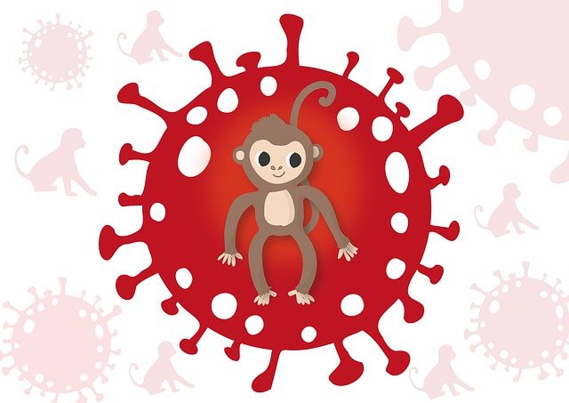 원숭이두창 증상, 감염경로 및 원인 & 원숭이두창 예방법!