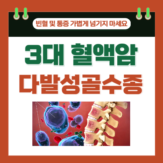 빈혈 및 뼈 통증, 가볍게 넘기지 마세요. 3대 혈액암 다발성골수종