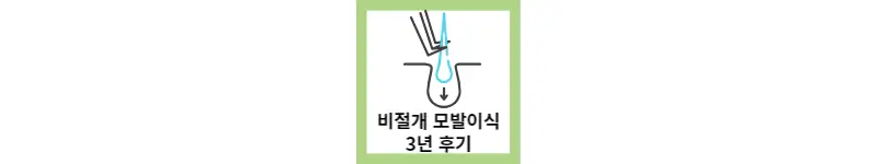 모발이식 3년 후기(feat.비절개)