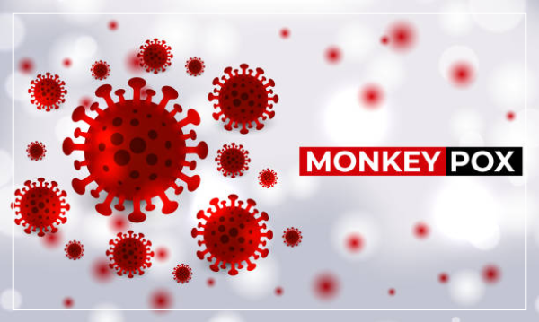 엠폭스 증상 원인 원숭이두창 감염경로 합병증 예방법 알아보기