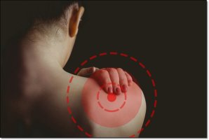 어깨 통증 - 어깨 회전근개파열 원인과 증상