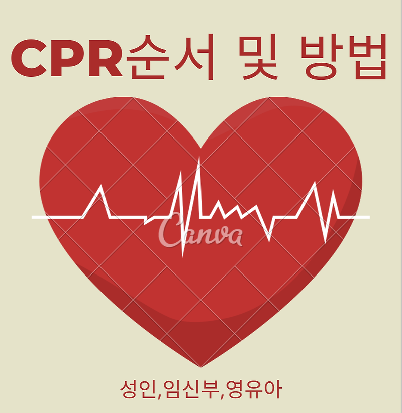 [생활상식정보] 심폐소생술(CPR) 순서 및 방법