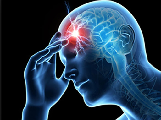 발병시 치명적 결과로 이어지는 대표적 뇌관련 질환 - 위험신호