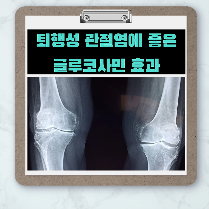 글루코사민 효능- 피부미용,무릎통증개선