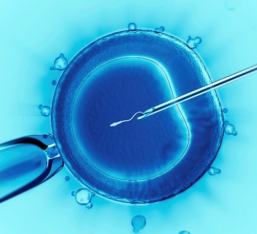 체외수정(IVF), 시험관아기의 방법과 성공율은 얼마나 되나요.