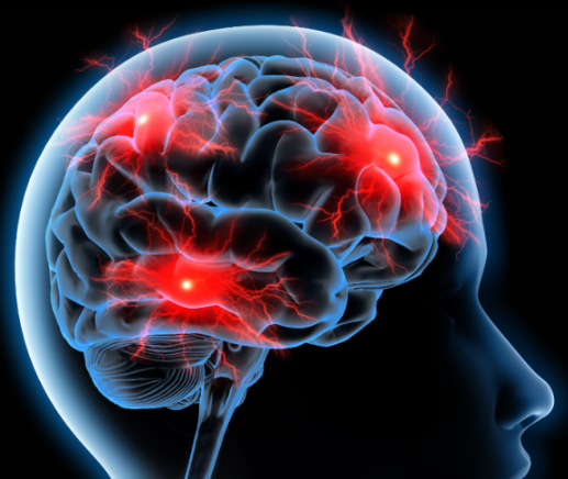 뇌진탕 : 축구와 일반적인 스포츠 부상 예방 및 치료