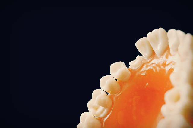 의료기관 종사자 - 치아관련 보철물을 만들어 내는 의료기사 [치과기공사]