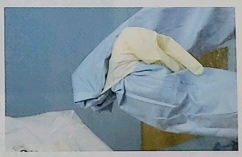 수술실 멸균 가운, 폐쇄적 멸균 글러브 착용법