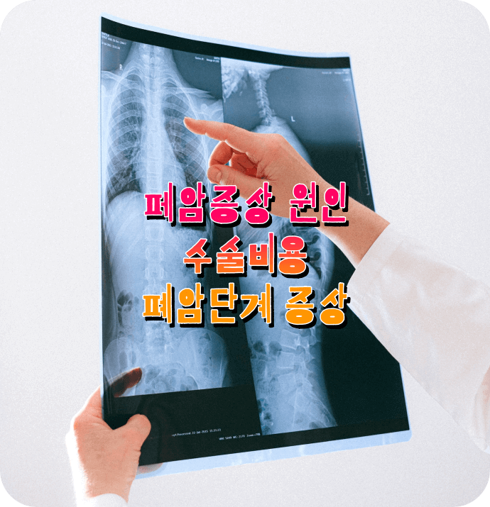 폐암 초기증상(3기 4기) 부작용 치료방법 생존율 / 수술 비용 가격 / 잘하는 병원