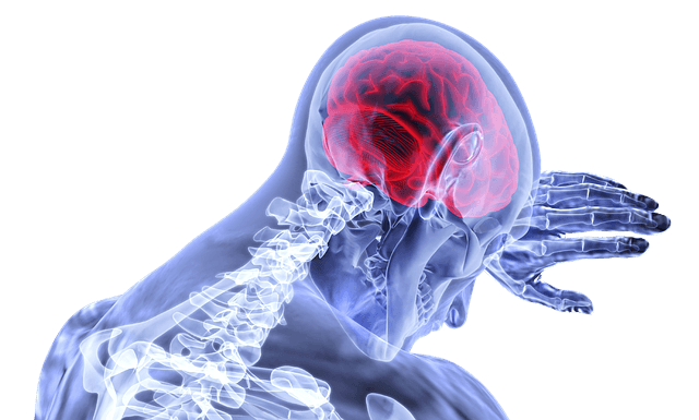 뇌졸중 뇌출혈 뇌경색 증상과 예방법