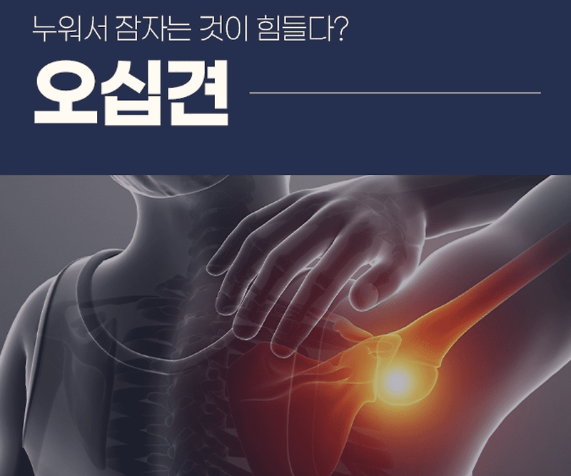 오십견 통증 완화운동법 치료방법 증상 원인 총정리