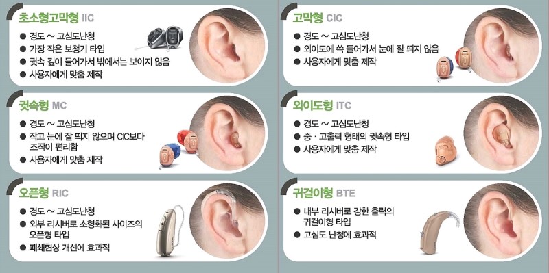 맞춤형(귓속형) 보청기 vs 오픈형(귀걸이형) 보청기 장단점 비교 ; 일산보청기