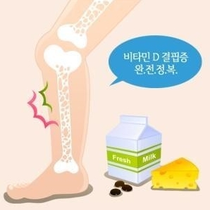 비타민D 부족증상 원인과 보충방법