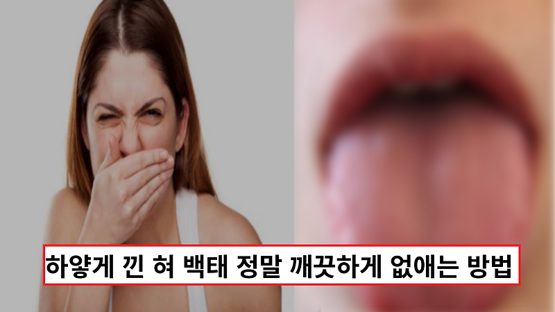 '입냄새의 원인' 하얗게 낀 혀 백태 정말 깨끗하게 없애는 방법