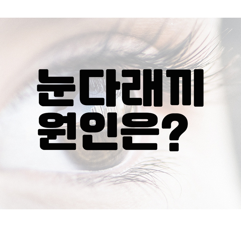눈 다래끼 원인은 무엇일까요? 맥립종의 원인?