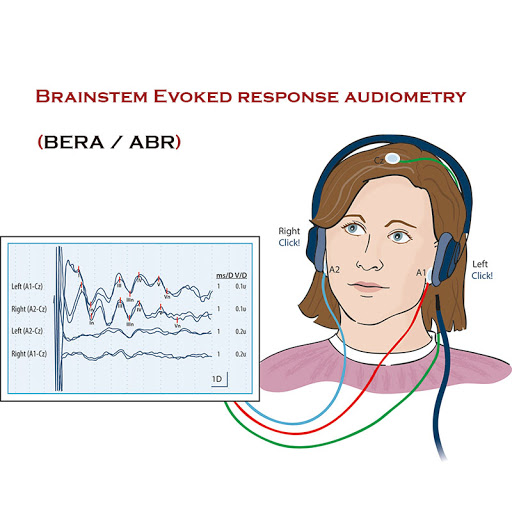 청성뇌간유발반응 검사(ABR)와 보청기 착용의 문제 - 이편한보청기