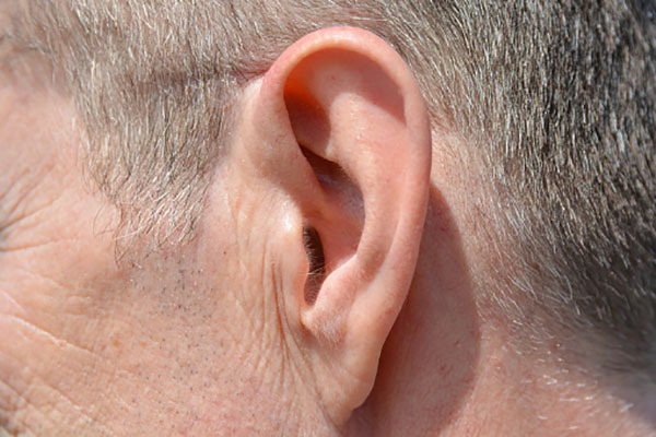 치매 귀주름과 연관성이 있는 걸까 치매 초기 증상 알아보기