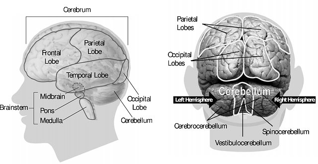 뇌경색 : 원인과 전조 증상 및 치료