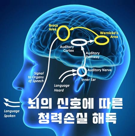 [연구] 뇌의 신호를 통한 청력 손실 해독 - 이편한보청기