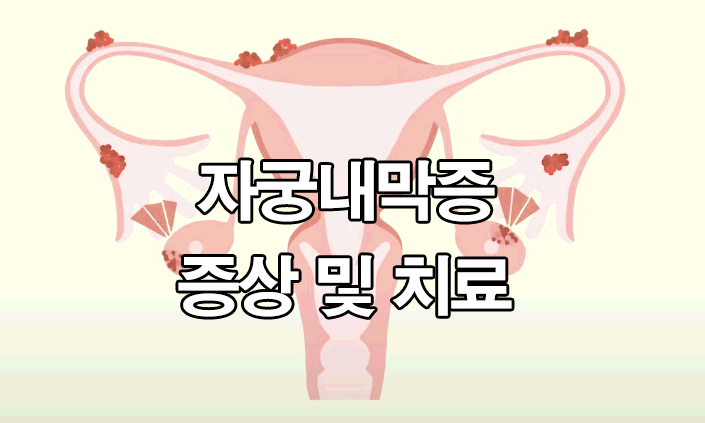 자궁내막증 증상 : 치료