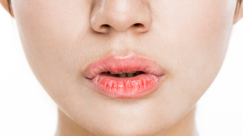 건조한 계절에 갈라지는 입술, 촉촉한 입술을 위해 보습제 이용.