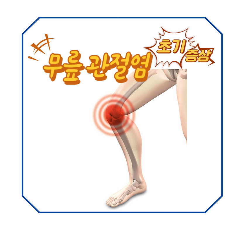 무릎 관절염 초기증상,징후 및 조치