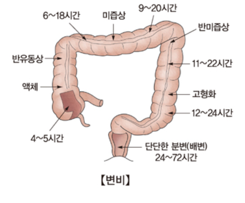 변비 해결방법/원인/치료