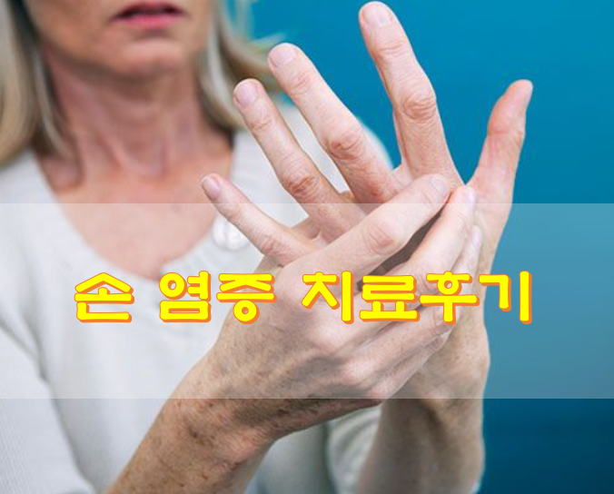 손 염증 치료 후기