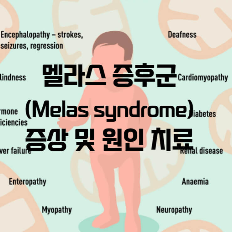 멜라스 증후군(Melas syndrome) 증상 및 원인 치료