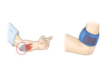 골프엘보 원인과 증상, 예방법, 치료법 알아보기