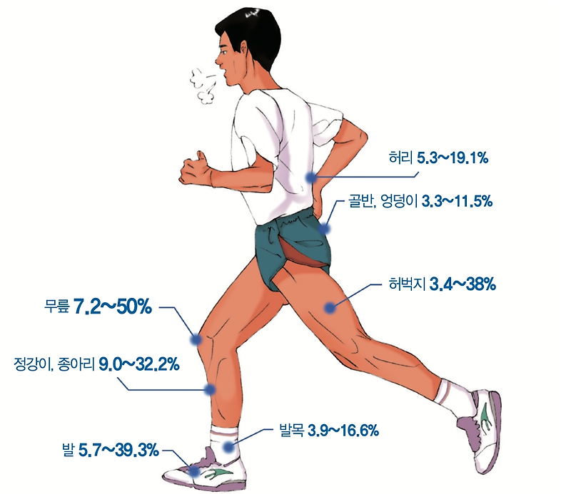 달리기 부상, 무릎 통증의 원인과 치료