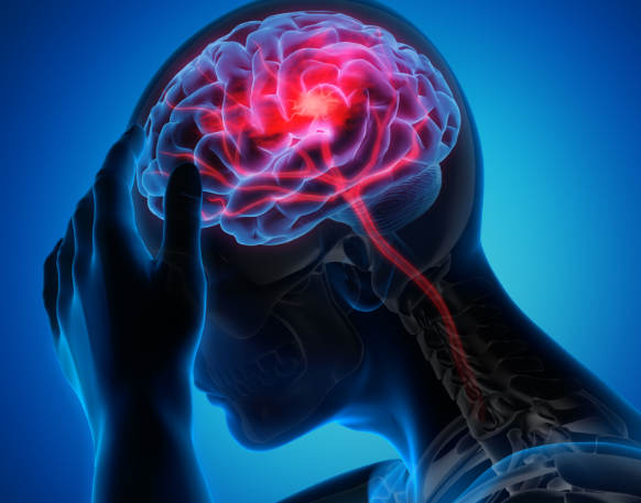 치명적인 뇌졸중의 원인과 증상 그리고 예방과 치료방법은?