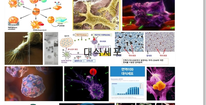 사례별 모음. 대식세포 기대되...