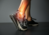 발목 통증 및 인대 늘어났을때 치료방법 과 발목 인대파열 증상 알아보기