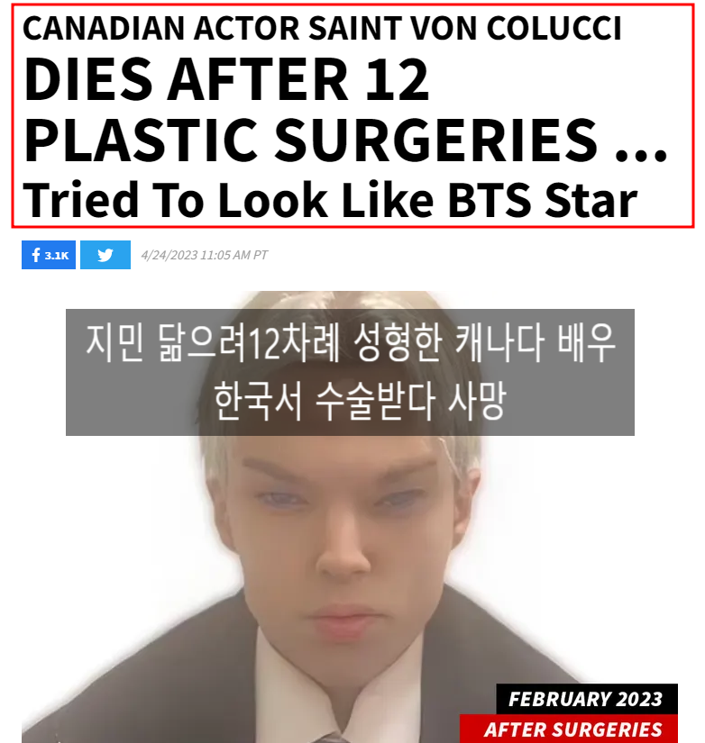 BTS 지민 닮으려 12차례 성형한 캐나다 배우 콜루치 한국서 수술받다 사망 향년 22세