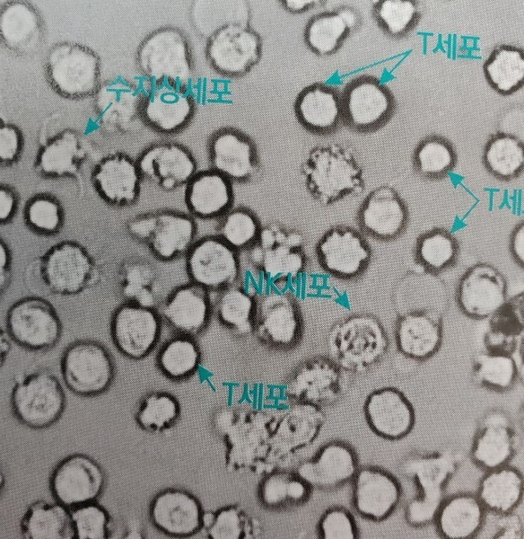 녹십자랩셀의  NK 세포 치료제란 무엇인가?