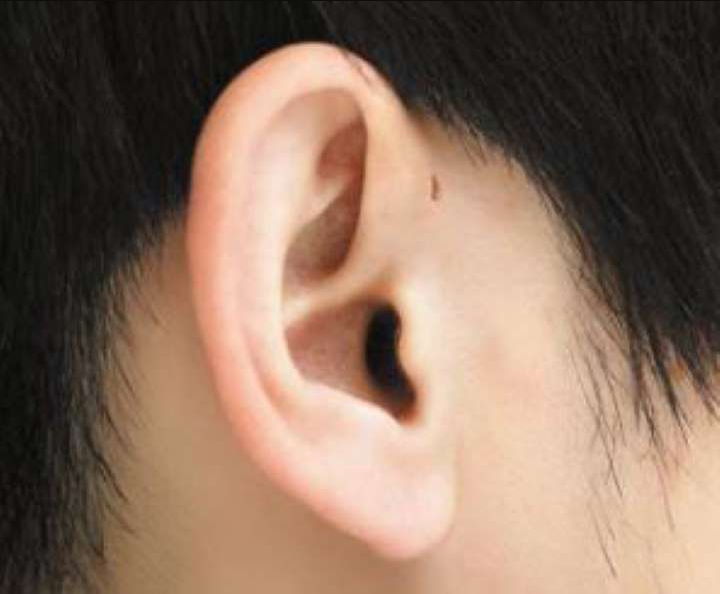 귀에서 삐소리 이명 원인과 개선방법