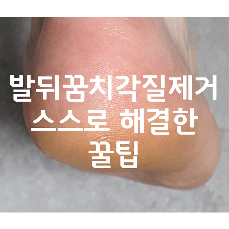 발뒤꿈치각질제거 꿀팁! 제거제 안쓰고 보들해진 후기(셀프해결!)