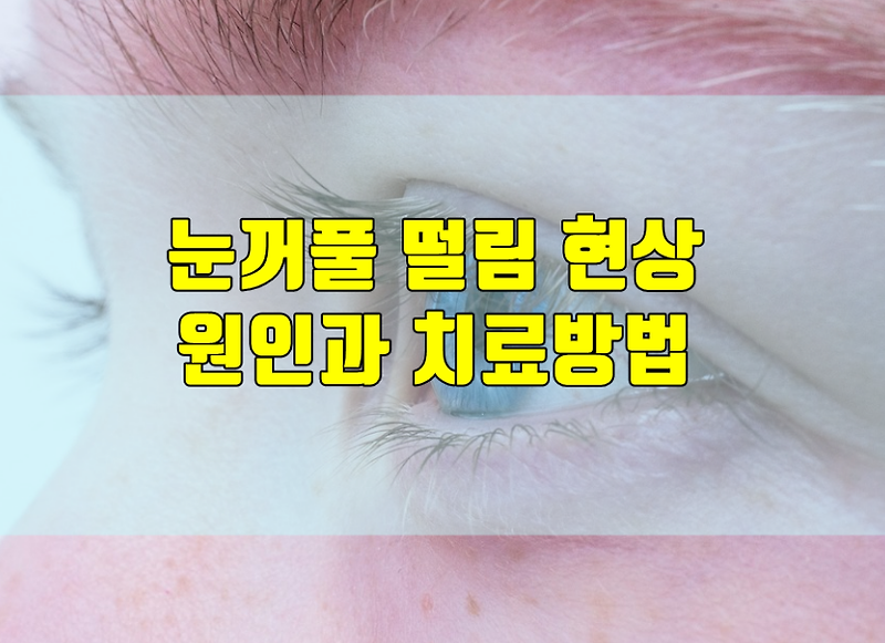 눈꺼풀 떨림 현상 원인과 치료방법