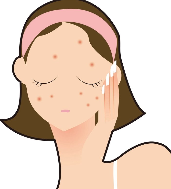 깨끗한 피부를 위한 중요한 지침 여드름 치료와 예방을 위한 조언