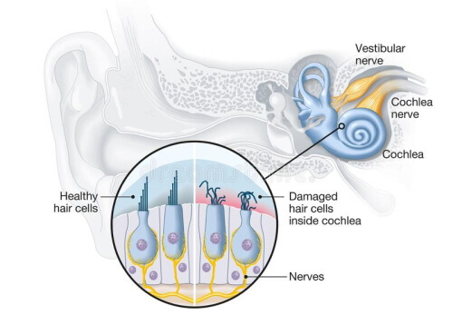 연령에 따른 청력 손실의 근본적인 원인으로서 유모세포 손상 관련연구