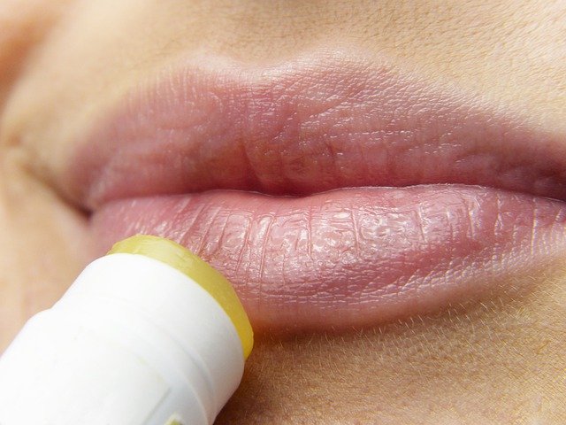 입술 포진 헤르페스 바이러스 원인 및 증상 & 입술 포진 빨리 낫는법! 헤르페스 치료 제대로 알아보자!